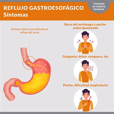 sintomas de reflujo gastrico